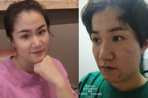 支援一月，容顏雖改初心依舊